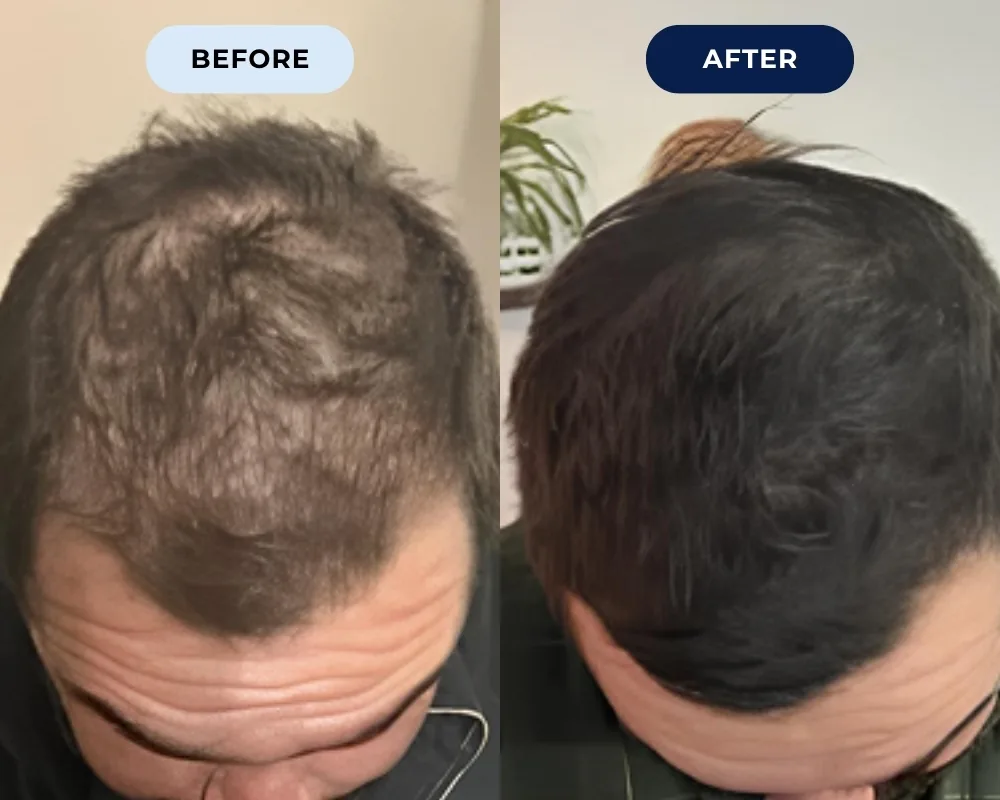 Before and after hair growth result 10