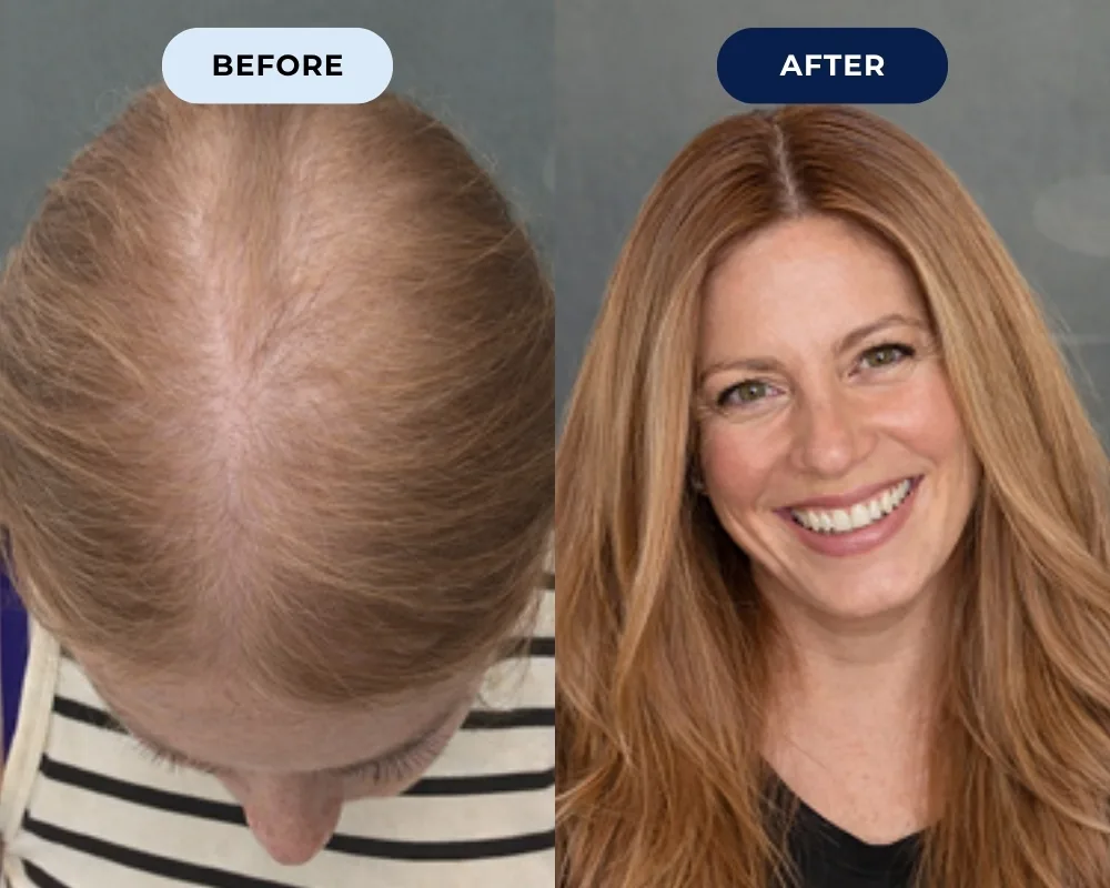 Before and after hair growth result 8