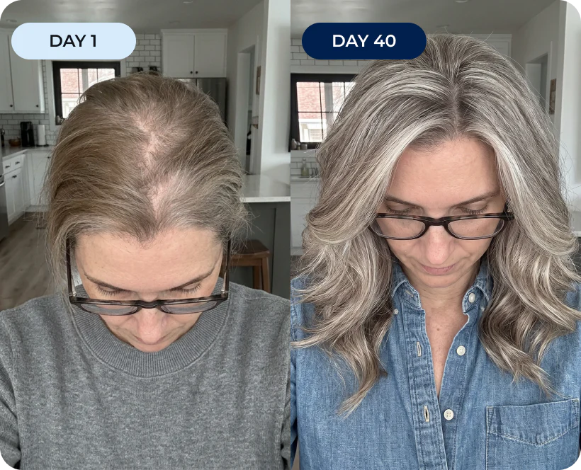 Breaking the Family Hair Loss Curse